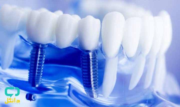 رتبه قبولی تکنسین پروتز دندانی 98